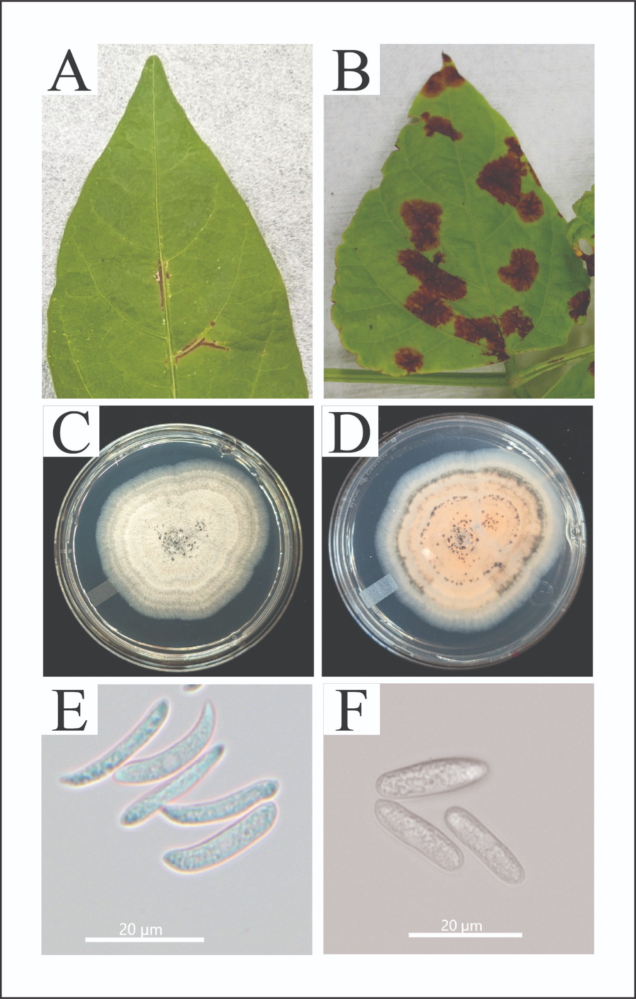 First Report of Anthracnose Caused by i Colletotrichum magnum i on Lima Bean in South Carolina